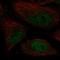 DNA Polymerase Kappa antibody, HPA069375, Atlas Antibodies, Immunofluorescence image 