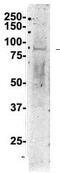 Nucleolin antibody, GTX47363, GeneTex, Western Blot image 