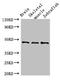 Bone Morphogenetic Protein 4 antibody, LS-C318250, Lifespan Biosciences, Western Blot image 