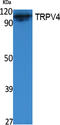 Transient Receptor Potential Cation Channel Subfamily V Member 4 antibody, A00565-1, Boster Biological Technology, Western Blot image 