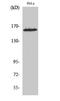Zinc Finger Protein 608 antibody, A12737-1, Boster Biological Technology, Western Blot image 