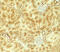 Vezatin, Adherens Junctions Transmembrane Protein antibody, 7959, ProSci, Immunohistochemistry paraffin image 