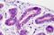 Glycogen Synthase Kinase 3 Beta antibody, MBS244854, MyBioSource, Immunohistochemistry paraffin image 