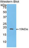 Interleukin 1 Receptor Antagonist antibody, LS-C304192, Lifespan Biosciences, Western Blot image 