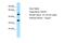 CCR4-NOT Transcription Complex Subunit 9 antibody, A09328, Boster Biological Technology, Western Blot image 