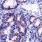 MutS Homolog 2 antibody, MBS302744, MyBioSource, Immunohistochemistry paraffin image 