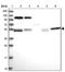 Coiled-Coil Domain Containing 8 antibody, NBP1-85085, Novus Biologicals, Western Blot image 