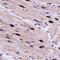 Egl-9 Family Hypoxia Inducible Factor 3 antibody, NB100-303, Novus Biologicals, Immunohistochemistry paraffin image 