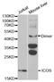 Inducible T Cell Costimulator antibody, LS-B11916, Lifespan Biosciences, Western Blot image 