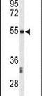 Centromere Protein I antibody, PA5-26624, Invitrogen Antibodies, Western Blot image 