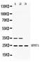 Hypoxanthine Phosphoribosyltransferase 1 antibody, PB10071, Boster Biological Technology, Western Blot image 