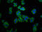 Gastrin Releasing Peptide Receptor antibody, LS-C670213, Lifespan Biosciences, Immunofluorescence image 