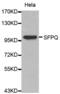 Splicing Factor Proline And Glutamine Rich antibody, abx000914, Abbexa, Western Blot image 