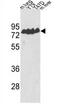 Endothelin Converting Enzyme 1 antibody, AP17300PU-N, Origene, Western Blot image 