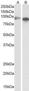 Scavenger Receptor Class B Member 1 antibody, 43-580, ProSci, Western Blot image 