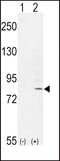 Fibroblast Growth Factor Receptor 1 antibody, PA5-24590, Invitrogen Antibodies, Western Blot image 