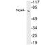 NADPH Oxidase 4 antibody, LS-C199947, Lifespan Biosciences, Western Blot image 