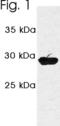 Proteasome activator complex subunit 3 antibody, PA1-961, Invitrogen Antibodies, Western Blot image 