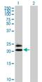 CD20 antigen-like 2 antibody, H00064232-B02P, Novus Biologicals, Western Blot image 