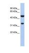 Sulfotransferase Family 1B Member 1 antibody, NBP1-54403, Novus Biologicals, Western Blot image 