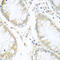 Cullin 3 antibody, 13-797, ProSci, Immunohistochemistry paraffin image 