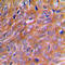 BCL2 Interacting Protein 2 antibody, LS-C351872, Lifespan Biosciences, Immunohistochemistry paraffin image 