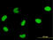 Deoxyuridine Triphosphatase antibody, LS-B4315, Lifespan Biosciences, Immunofluorescence image 