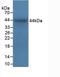 Integrin Subunit Alpha 5 antibody, LS-C700358, Lifespan Biosciences, Western Blot image 