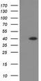 Hydroxyacid Oxidase 1 antibody, TA502105S, Origene, Western Blot image 