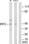 Interferon Regulatory Factor 2 antibody, TA311964, Origene, Western Blot image 