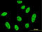 Cyclin Dependent Kinase Like 1 antibody, LS-B6189, Lifespan Biosciences, Immunofluorescence image 