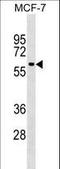 SHOC2 Leucine Rich Repeat Scaffold Protein antibody, LS-C158966, Lifespan Biosciences, Western Blot image 