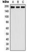 Insulin Like Growth Factor Binding Protein 3 antibody, orb256613, Biorbyt, Western Blot image 