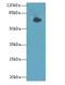 G Protein Nucleolar 1 (Putative) antibody, LS-C396013, Lifespan Biosciences, Western Blot image 