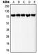 LIM Domain Kinase 2 antibody, GTX32211, GeneTex, Western Blot image 