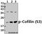 Cofilin 1 antibody, A01525S3, Boster Biological Technology, Western Blot image 