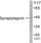 Synaptotagmin 1 antibody, LS-C192167, Lifespan Biosciences, Western Blot image 