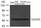 Glutamate Decarboxylase 2 antibody, GTX50783, GeneTex, Western Blot image 