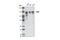 ADAM Metallopeptidase Domain 17 antibody, 3976S, Cell Signaling Technology, Western Blot image 