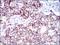 Activated Leukocyte Cell Adhesion Molecule antibody, GTX60798, GeneTex, Immunohistochemistry paraffin image 