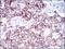 HB2 antibody, GTX60798, GeneTex, Immunohistochemistry paraffin image 