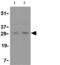 TNF Superfamily Member 11 antibody, ab62516, Abcam, Western Blot image 