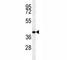 C-C Motif Chemokine Receptor 8 antibody, F40687-0.4ML, NSJ Bioreagents, Western Blot image 