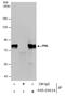 Promyelocytic Leukemia antibody, PA5-29614, Invitrogen Antibodies, Immunoprecipitation image 