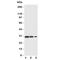 TNF receptor-associated factor 2 antibody, R31114, NSJ Bioreagents, Western Blot image 