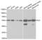 Dihydrolipoamide Dehydrogenase antibody, abx004138, Abbexa, Western Blot image 