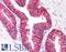 ATP Binding Cassette Subfamily C Member 4 antibody, LS-B4, Lifespan Biosciences, Immunohistochemistry paraffin image 