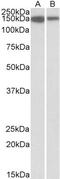 MCF.2 Cell Line Derived Transforming Sequence Like antibody, PA5-37934, Invitrogen Antibodies, Western Blot image 