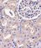 COP9 Signalosome Subunit 7B antibody, M12717, Boster Biological Technology, Immunohistochemistry paraffin image 