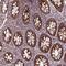 Translocase Of Outer Mitochondrial Membrane 40 antibody, PA5-57575, Invitrogen Antibodies, Immunohistochemistry paraffin image 